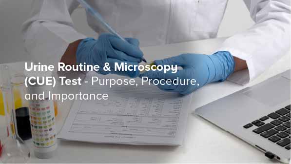 Urine Routine & Microscopy (CUE) Test: What You Need to Know